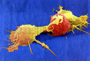 Immuntherapie